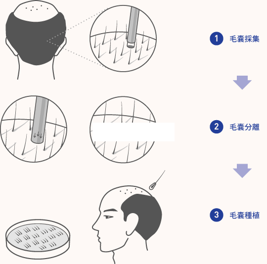 头发草莓视频黄网站在线看个过程