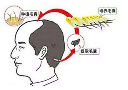 草莓视频官方网站手术过程